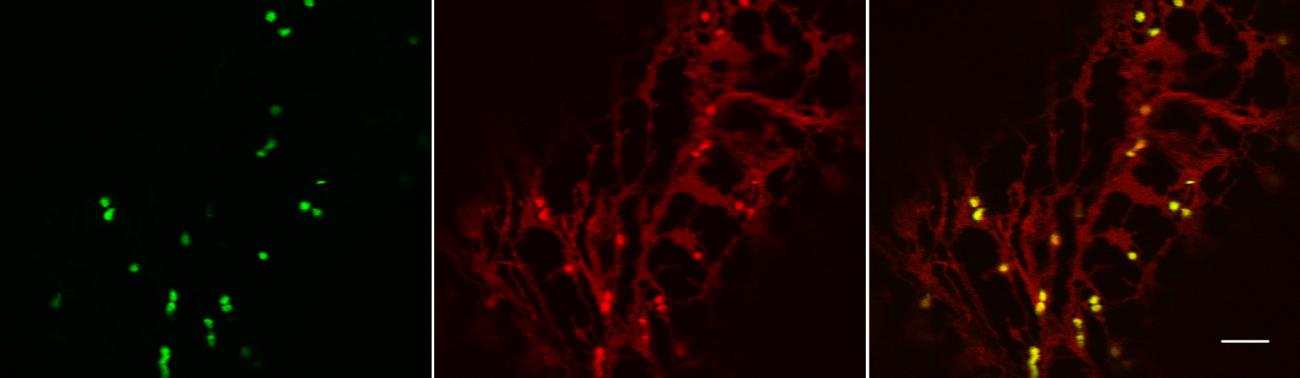 Live-cell imaging by laser scanning confocal microscopy (LCSM) is used here to show Golgi-localization of enzymes involved in plant cell wall assembly.