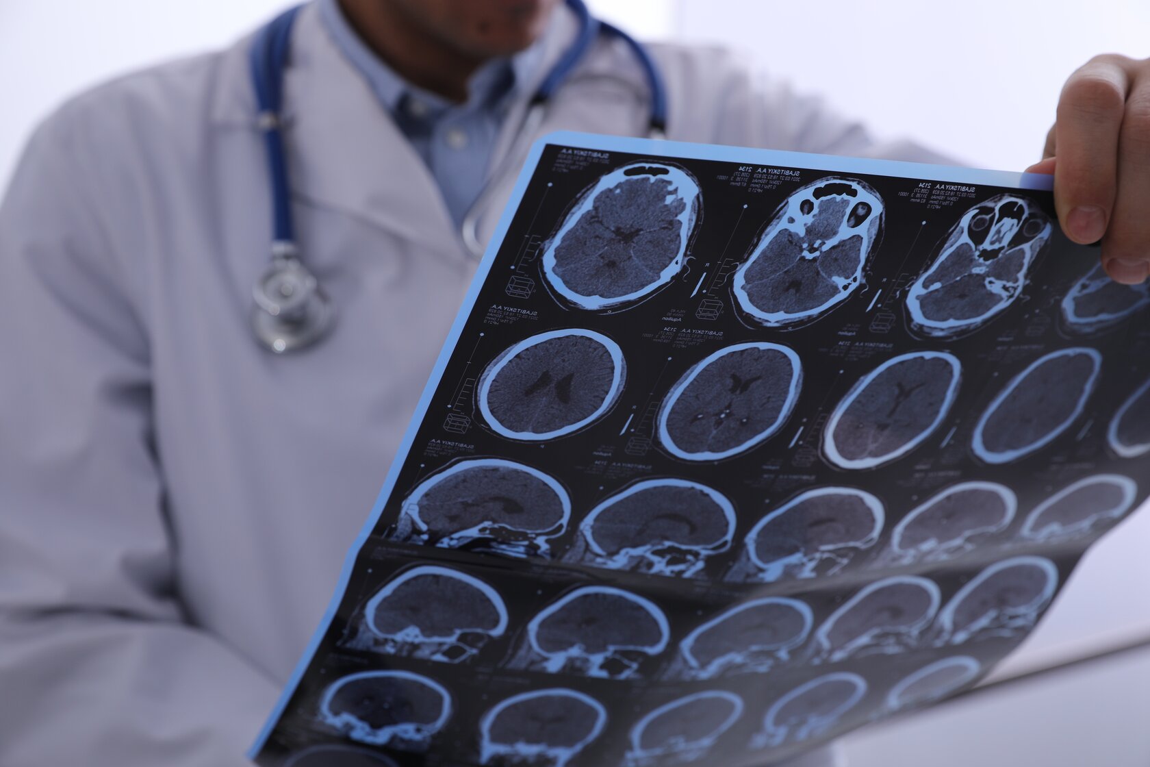 Brain scans
