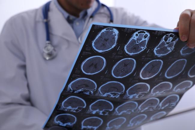 Brain scans